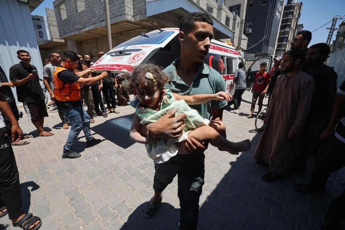 Child injured by airstrike carried into hospital