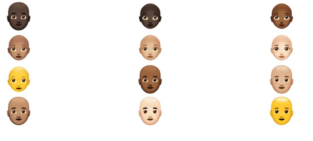 Struggling with Hair Loss? Uncover the Revolutionary AI Breakthrough Transforming Treatment!