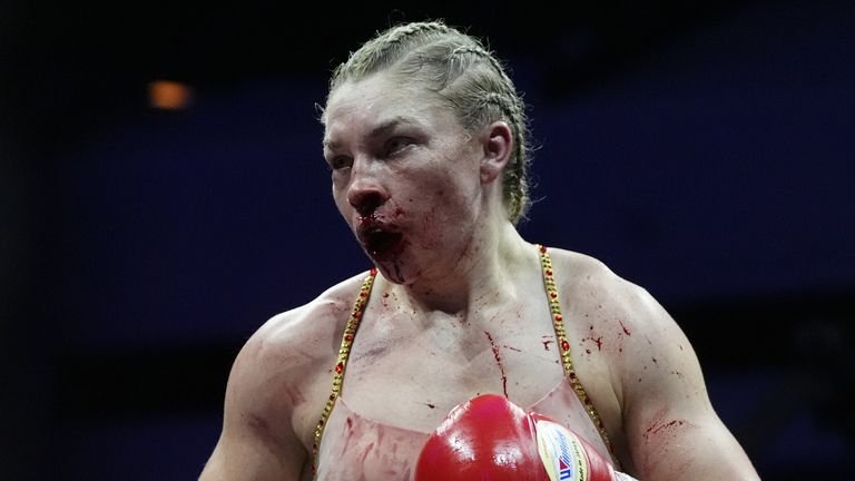 Lauren Price bleeding during fight