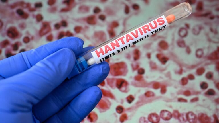 Here’s a more engaging version of the title:

“Global Hantavirus Outbreak? Here’s Why the Latest Data Says It’s Unlikely
