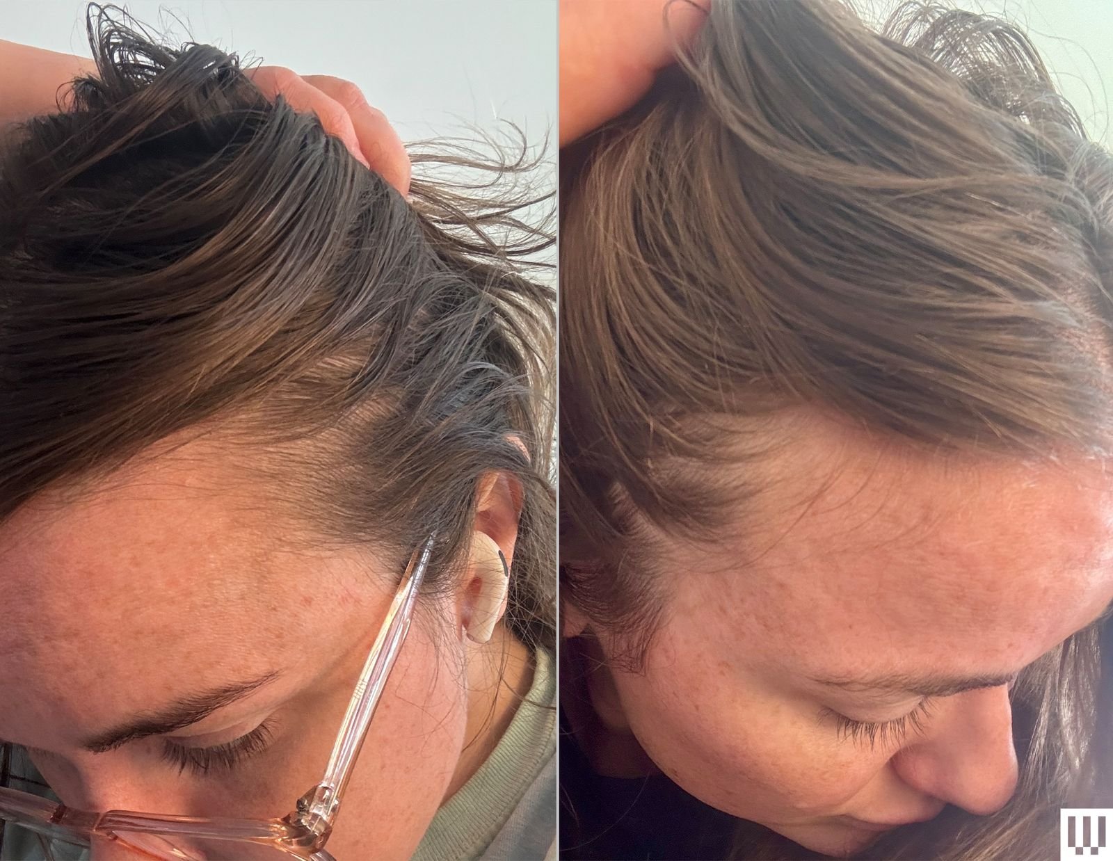 Side profile showing improved hair texture after consistent use of Laduora Duo