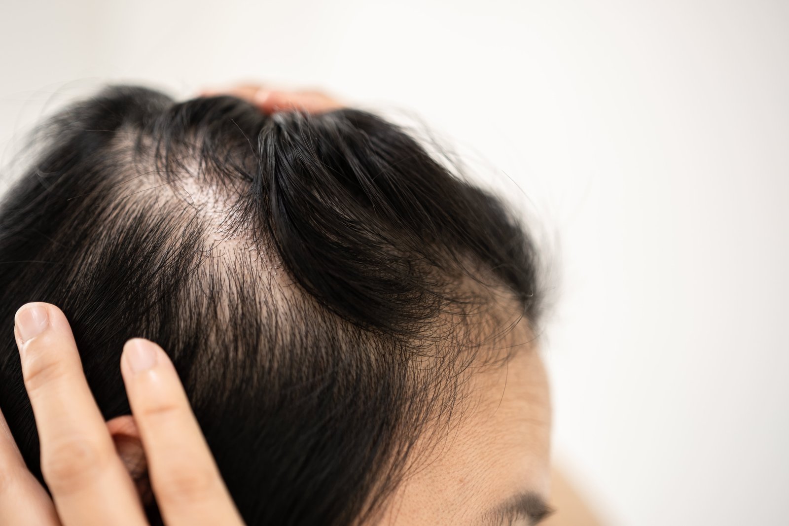 GLP-1 medications adn their influence on hair care